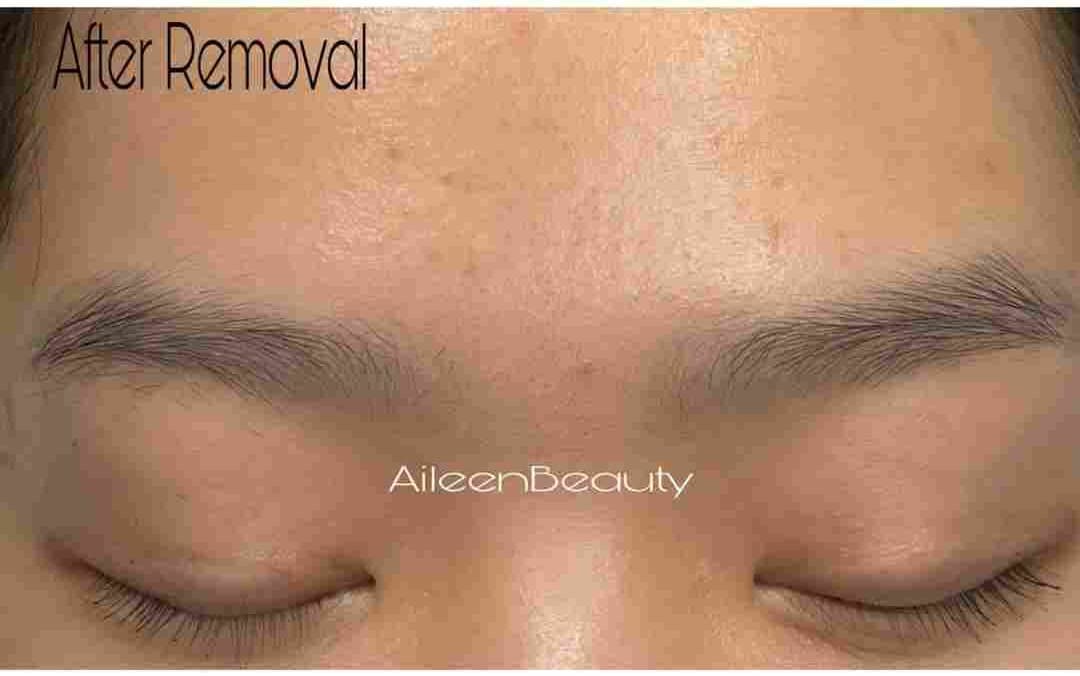 Old microblading after non-laser eyebrow tattoo removal (real client, unretouched)