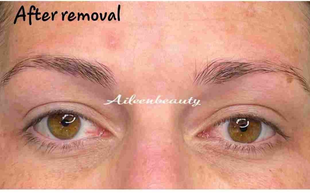 Saturated powder brows after non-laser eyebrow tattoo removal (real client, unretouched)