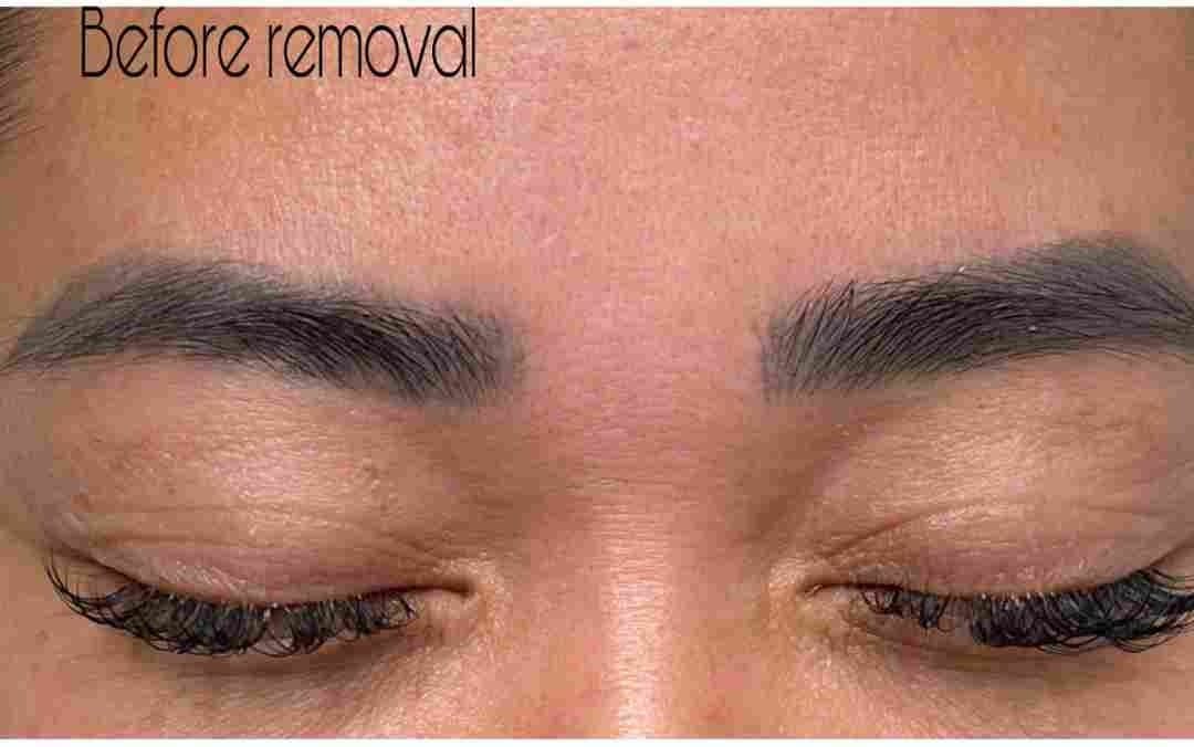 Faded cosmetic tattoo before non-laser removal — warm / uneven pigment (real client)