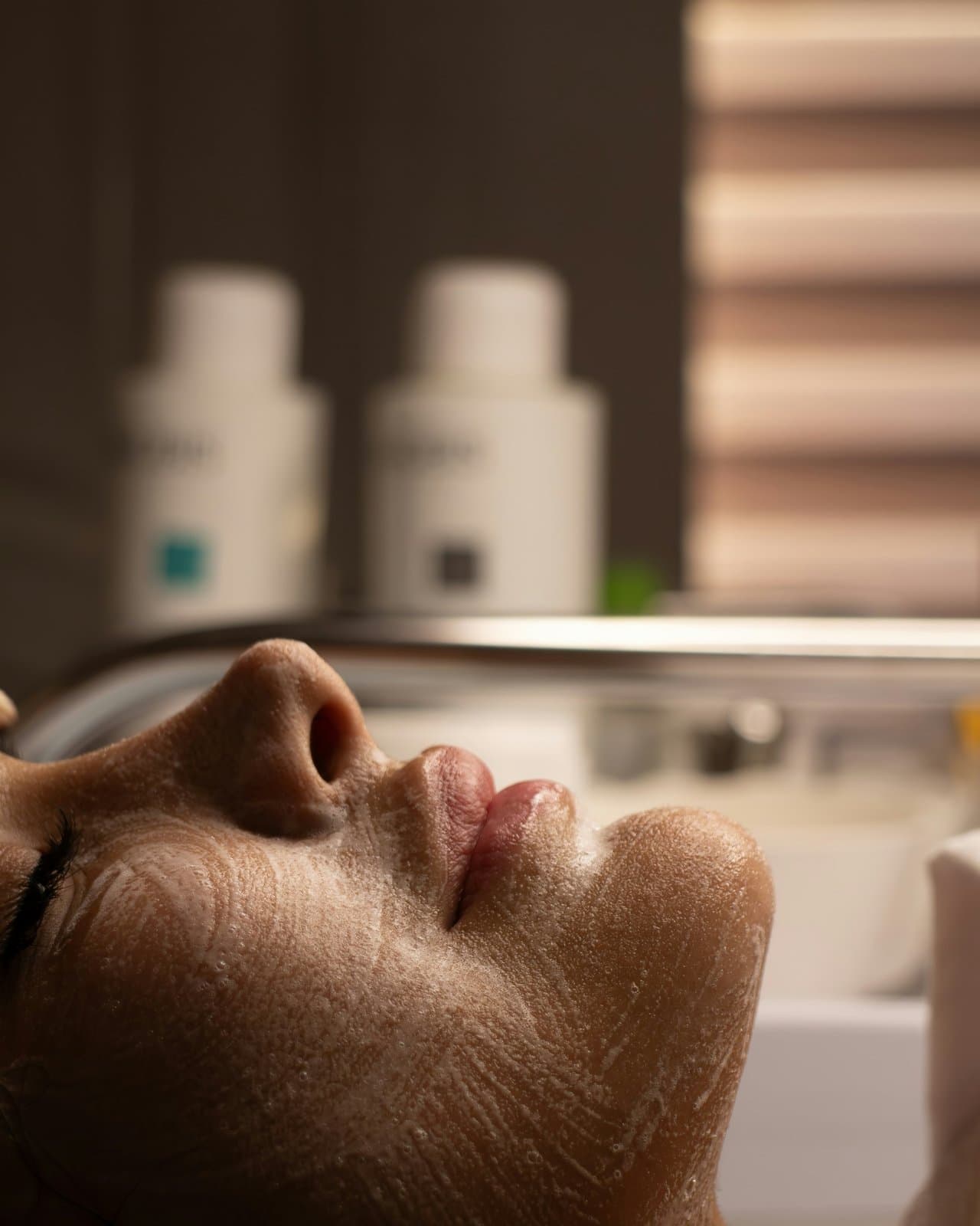 Melasma Treatment